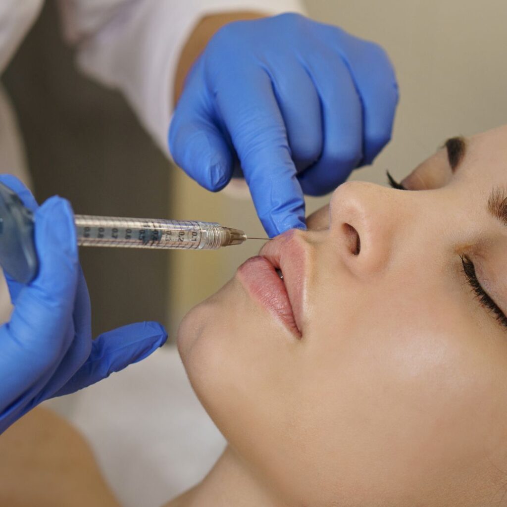 filler labbra a Brescia